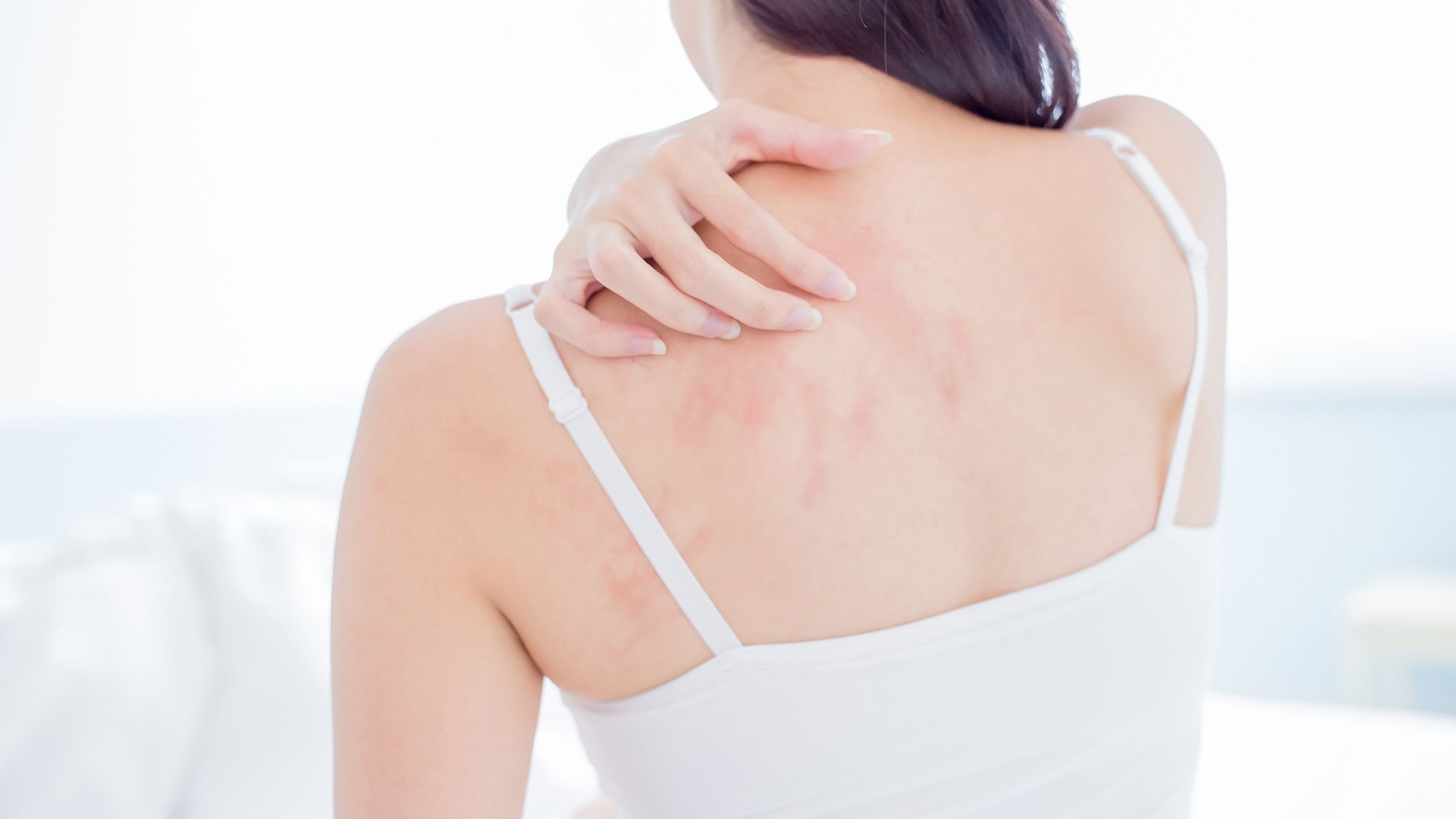 7 zarte Pflege Tipps für trockene Haut